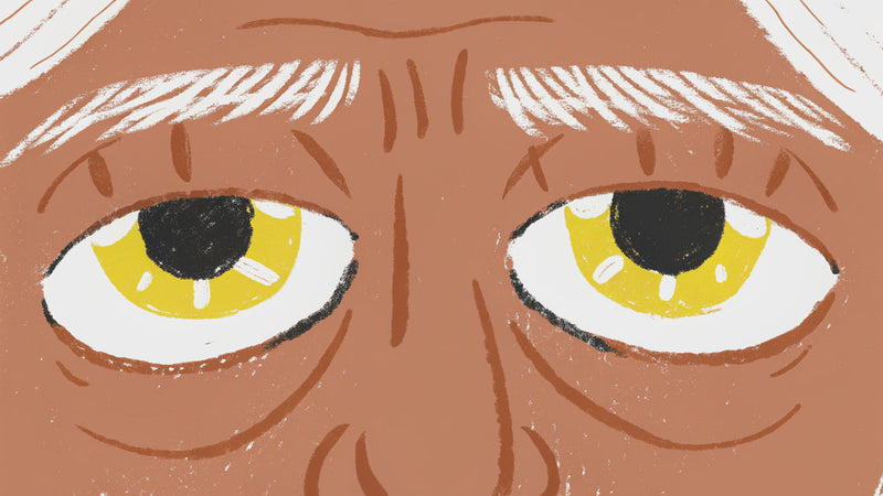What Causes Eye Bags?