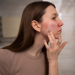 Facial Redness? How Red Light Therapy Can Help with Rosacea