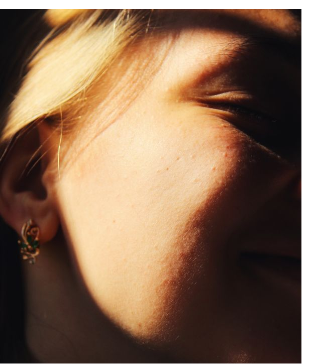 Red Light Therapy for Skin: Benefits, Uses & What to Know