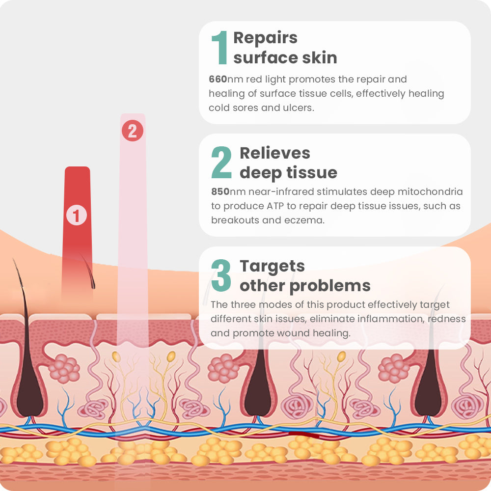 Red light therapy benefits diagram: 660nm and 850nm light for skin repair, inflammation reduction, and wound healing